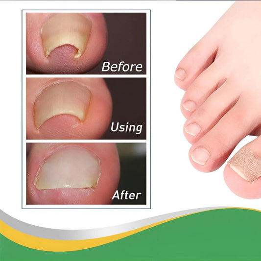 Pack de Parches para uñeros